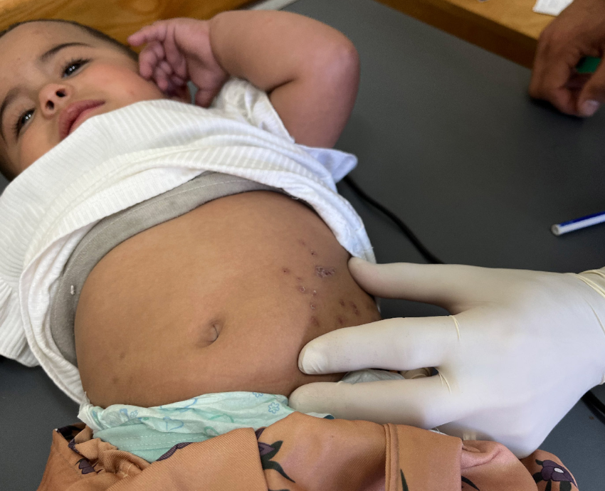 baby being examined by a health worker