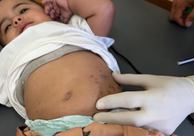 baby being examined by a health worker